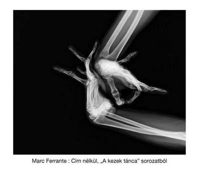 Marc Ferrante: Cím nélkül, "A kezek tánca" sorozatból