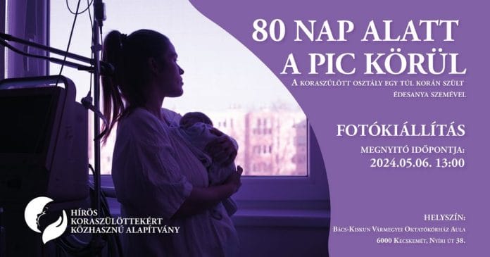 Fotókiállítás 80 NAP ALATT A PIC KÖRÜL – A koraszülött részleg egy túl korán szült édesanya szemével – megnyitó
